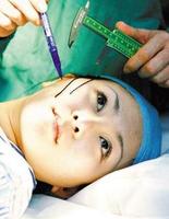 ��ͳ����ȥ�߷����ı׶�