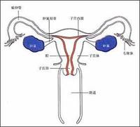 子宫腺肌瘤的易发人群
