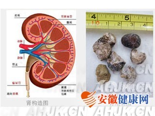 ����ʯ�����ݵ������ģ�