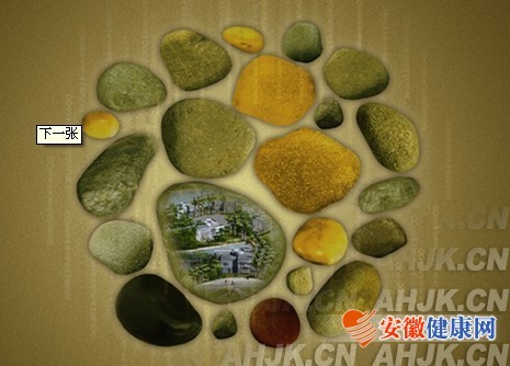 冲击波碎石并发症及处理方法