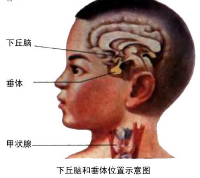 下丘脑综合征与不育