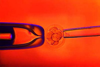 “试管婴儿”也需适应症