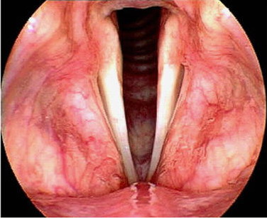 ������֮��������