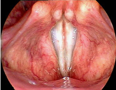 ������֮��������