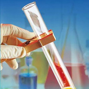 检查肾病的几个项目