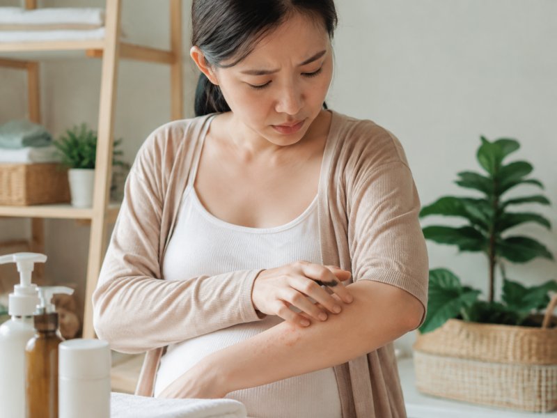 孕妇得了脓疱疮能不能用外用药,日常护理要怎么避开风险?
