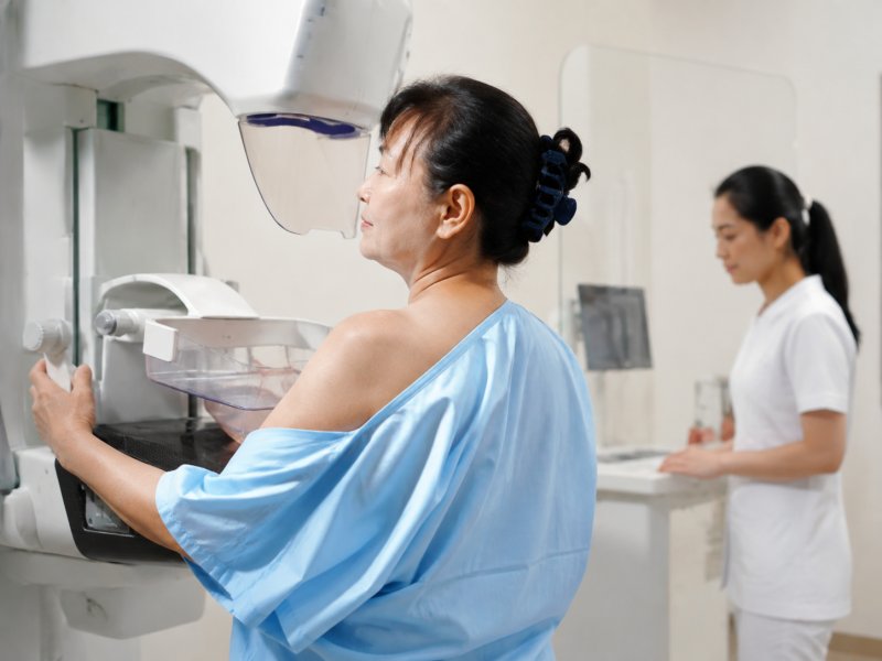 岁以上的女性要不要每年做乳腺X线检查?有什么依据?