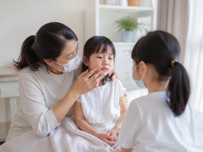 家里一个孩子出水痘，另一个怎么预防会不会被传染？需要打疫苗吗？