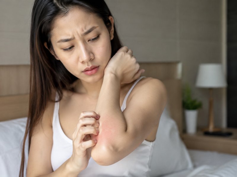 避孕套过敏有什么症状?怎么判断是不是过敏了