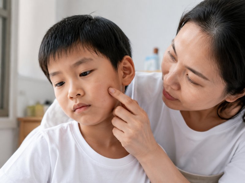 小孩脸上长扁平疣怎么办？要不要去医院治疗？