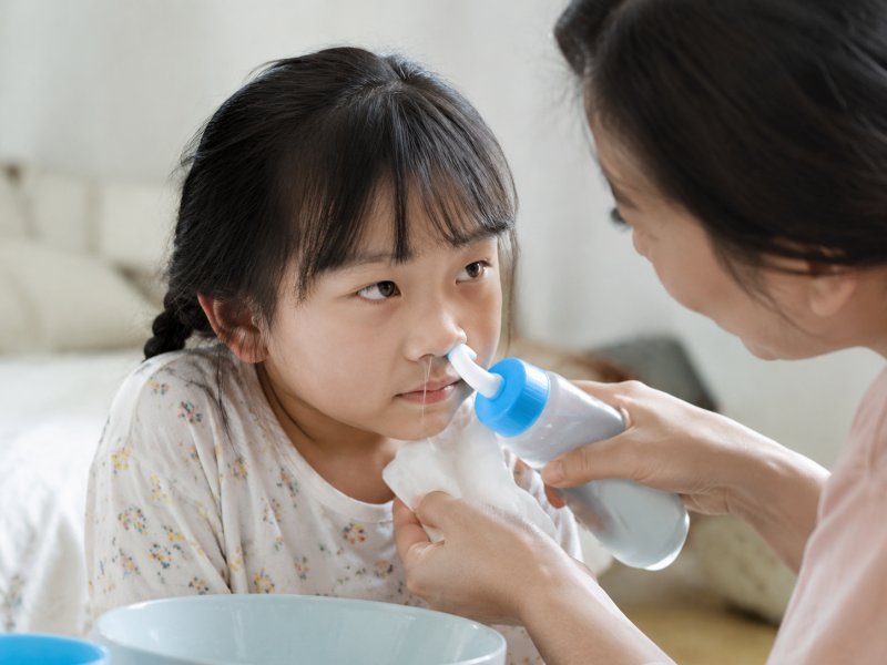 孩子过敏性鼻炎,日常护理上能不能通过洗鼻子来减少发作次数?