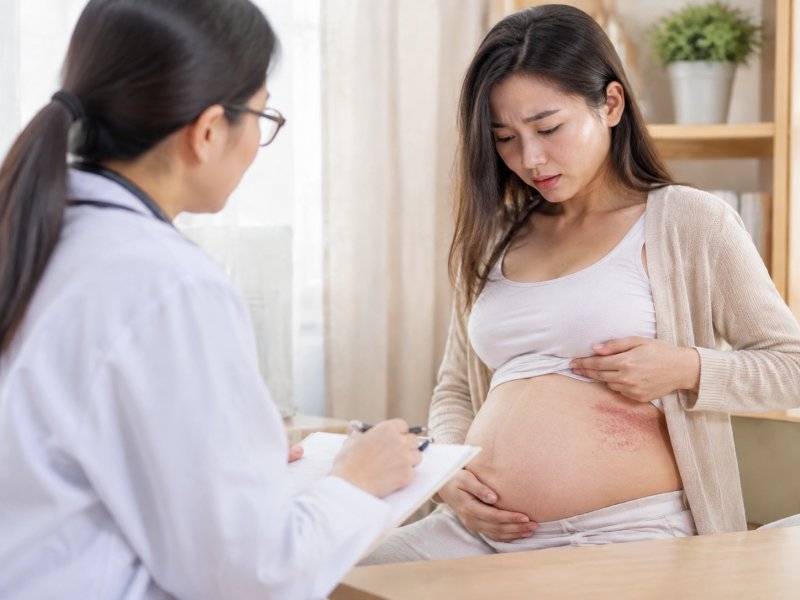 孕妇得了带状疱疹会不会影响胎儿?要不要终止妊娠