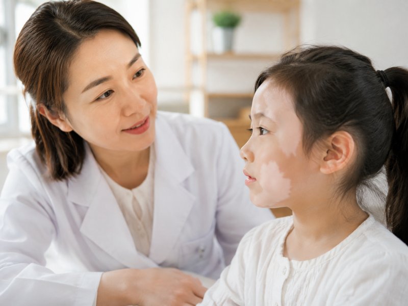 孩子脸上有白癜风能不能做皮移植?多大年龄适合做这个手术