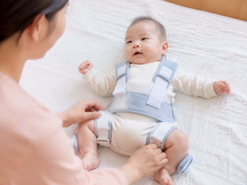 宝宝髋关节脱位戴吊带要戴多久?日常护理能不能洗澡