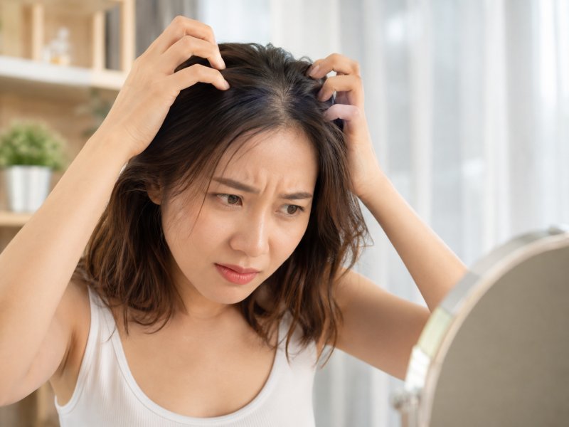 为什么每天洗头还是痒得厉害,头皮屑越洗越多是什么原因