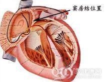 残窦综合征