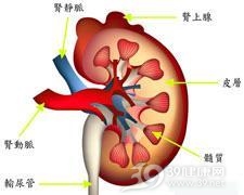 常染色体显性多囊肾