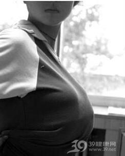巨乳症