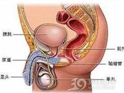 出血性膀胱炎