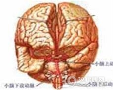 出血性休克和脑病综合征