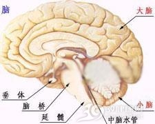 多发梗塞性痴呆