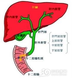 胆管炎