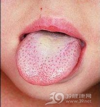 丹痧