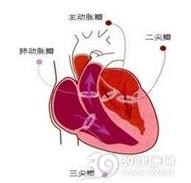 二尖瓣脱垂综合征