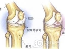 费尔蒂综合征