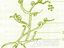 肺放线菌病
