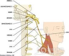 副神经损伤