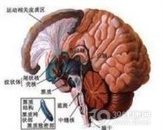 吩噻嗪类抗精神病药物中毒