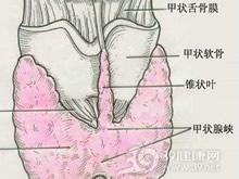 放射性甲状腺炎