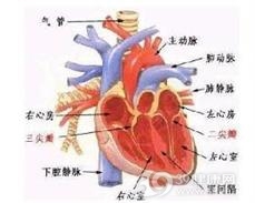 非细菌性血栓性心内膜炎