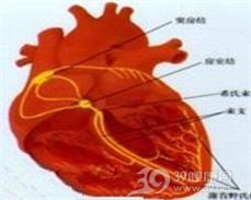 非阵发性交接区性心动过速