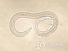 钩虫性十二指肠炎综合征
