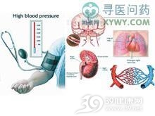 戈登综合征