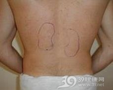 关格