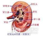 高钙血症肾病