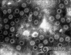 感染性腹泻