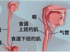 膈上食管憩室
