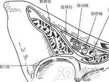 股外侧皮神经卡压综合征