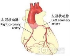 冠状动脉终止异常