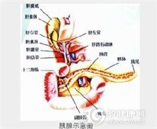 蛔虫性急性胰腺炎
