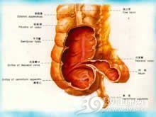 活动盲肠综合征