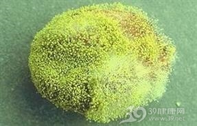 黄曲霉素中毒