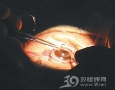 花翳自陷