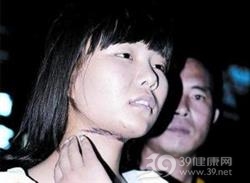 颈部勒伤