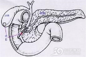 结肠瘘