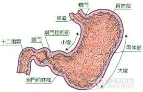 巨大肥厚性胃炎